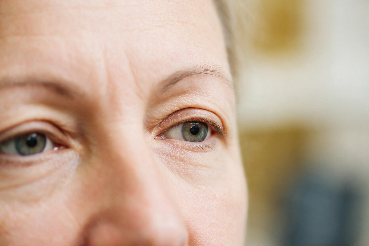 Upper eyelid margin position being measured to separate ptosis from hooded eyelids