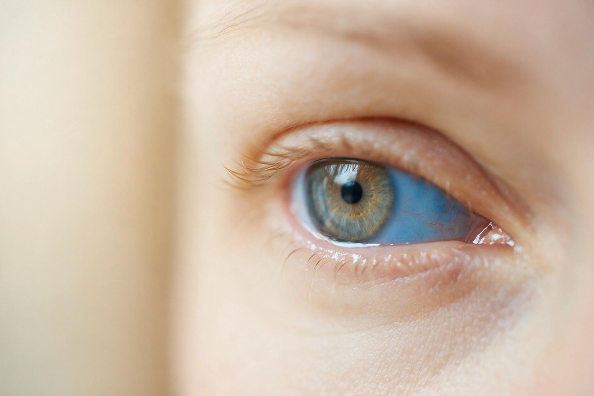 Tear drainage pathway from the eye through the tear sac into the nose