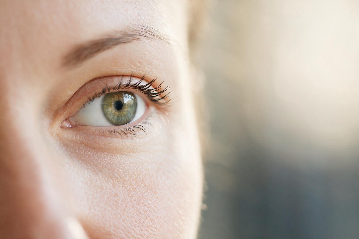 Stye (hordeolum) forming at the eyelid margin