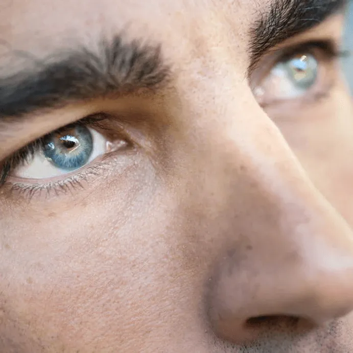 Prosthetic Eye